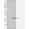 DF7128 at 1/100 staining Rat brain tissue by IHC-P. The sample was formaldehyde fixed and a heat mediated antigen retrieval step in citrate buffer was performed. The sample was then blocked and incubated with the antibody for 1.5 hours at 22¡ãC. An HRP conjugated goat anti-rabbit antibody was used as the secondary
