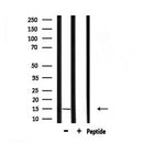 DF7133 staining HepG2 by IF/ICC. The sample were fixed with PFA and permeabilized in 0.1% Triton X-100,then blocked in 10% serum for 45 minutes at 25¡ãC. The primary antibody was diluted at 1/200 and incubated with the sample for 1 hour at 37¡ãC. An  Alexa Fluor 594 conjugated goat anti-rabbit IgG (H+L) Ab, diluted at 1/600, was used as the secondary antibod