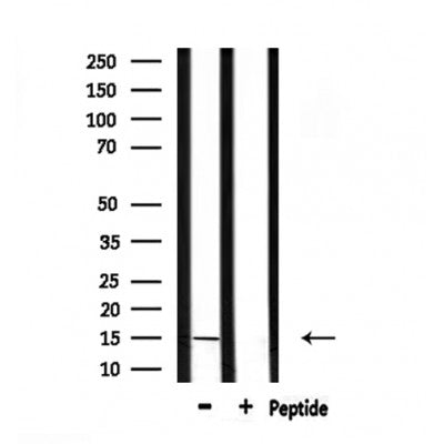DF7133 staining HepG2 by IF/ICC. The sample were fixed with PFA and permeabilized in 0.1% Triton X-100,then blocked in 10% serum for 45 minutes at 25¡ãC. The primary antibody was diluted at 1/200 and incubated with the sample for 1 hour at 37¡ãC. An  Alexa Fluor 594 conjugated goat anti-rabbit IgG (H+L) Ab, diluted at 1/600, was used as the secondary antibod