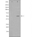 Western blot analysis of Hela whole cell lysates, using KLF5  Antibody. The lane on the left is treated with the antigen-specific peptide.