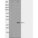 DF7136 at 1/100 staining Human uterus tissue by IHC-P. The sample was formaldehyde fixed and a heat mediated antigen retrieval step in citrate buffer was performed. The sample was then blocked and incubated with the antibody for 1.5 hours at 22¡ãC. An HRP conjugated goat anti-rabbit antibody was used as the secondary