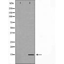 Western blot analysis of extracts of Mouse pituitary , using LHB antibody. The lane on the left is treated with the antigen-specific peptide.