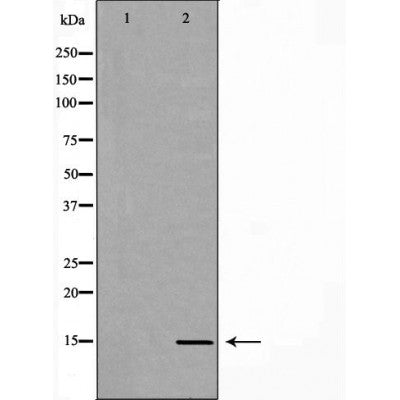Western blot analysis of extracts of Mouse pituitary , using LHB antibody. The lane on the left is treated with the antigen-specific peptide.