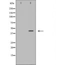 DF7141 at 1/100 staining Human gastric tissue by IHC-P. The sample was formaldehyde fixed and a heat mediated antigen retrieval step in citrate buffer was performed. The sample was then blocked and incubated with the antibody for 1.5 hours at 22¡ãC. An HRP conjugated goat anti-rabbit antibody was used as the secondary