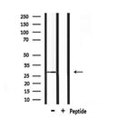Western blot analysis of extracts from mouse spleen, using POMC Antibody.