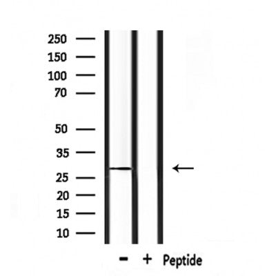 Western blot analysis of extracts from mouse spleen, using POMC Antibody.