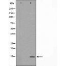 DF7155 at 1/100 staining Mouse muscle tissue by IHC-P. The sample was formaldehyde fixed and a heat mediated antigen retrieval step in citrate buffer was performed. The sample was then blocked and incubated with the antibody for 1.5 hours at 22¡ãC. An HRP conjugated goat anti-rabbit antibody was used as the secondary