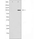 DF7158 staining COLO205 cells by IF/ICC. The sample were fixed with PFA and permeabilized in 0.1% Triton X-100,then blocked in 10% serum for 45 minutes at 25¡ãC. The primary antibody was diluted at 1/200 and incubated with the sample for 1 hour at 37¡ãC. An  Alexa Fluor 594 conjugated goat anti-rabbit IgG (H+L) antibody(Cat.