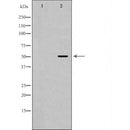 Western blot analysis of extracts of mouse heart, using HCRTR2 antibody. The lane on the left is treated with the antigen-specific peptide.