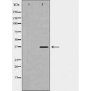 DF7165 at 1/100 staining Human gastric tissue by IHC-P. The sample was formaldehyde fixed and a heat mediated antigen retrieval step in citrate buffer was performed. The sample was then blocked and incubated with the antibody for 1.5 hours at 22¡ãC. An HRP conjugated goat anti-rabbit antibody was used as the secondary