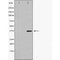DF7166 at 1/100 staining Mouse kidney tissue by IHC-P. The sample was formaldehyde fixed and a heat mediated antigen retrieval step in citrate buffer was performed. The sample was then blocked and incubated with the antibody for 1.5 hours at 22¡ãC. An HRP conjugated goat anti-rabbit antibody was used as the secondary