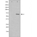 DF7167 at 1/100 staining Human prostate tissue by IHC-P. The sample was formaldehyde fixed and a heat mediated antigen retrieval step in citrate buffer was performed. The sample was then blocked and incubated with the antibody for 1.5 hours at 22¡ãC. An HRP conjugated goat anti-rabbit antibody was used as the secondary