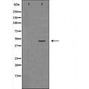 Western blot analysis of extracts of 231 ,using PAX2antibody. The lane on the left is treated with the antigen-specific peptide.