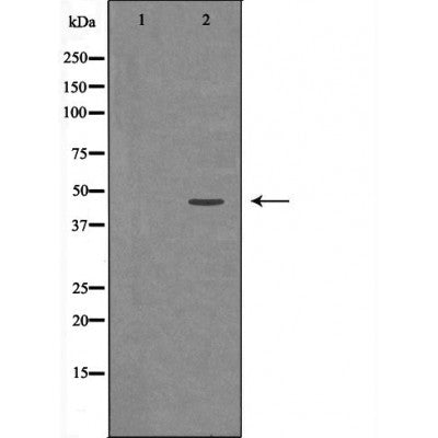 Western blot analysis of extracts of 231 ,using PAX2antibody. The lane on the left is treated with the antigen-specific peptide.