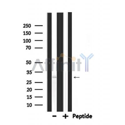 DF7170 at 1/100 staining Rat lung tissue by IHC-P. The sample was formaldehyde fixed and a heat mediated antigen retrieval step in citrate buffer was performed. The sample was then blocked and incubated with the antibody for 1.5 hours at 22¡ãC. An HRP conjugated goat anti-rabbit antibody was used as the secondary