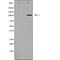 DF7172 at 1/100 staining Rat kidney tissue by IHC-P. The sample was formaldehyde fixed and a heat mediated antigen retrieval step in citrate buffer was performed. The sample was then blocked and incubated with the antibody for 1.5 hours at 22¡ãC. An HRP conjugated goat anti-rabbit antibody was used as the secondary