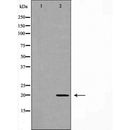 Western blot analysis of Hela cell lysate, using RAMP2 Antibody. The lane on the left is treated with the antigen-specific peptide.