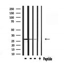 DF7174 at 1/100 staining Human gastric tissue by IHC-P. The sample was formaldehyde fixed and a heat mediated antigen retrieval step in citrate buffer was performed. The sample was then blocked and incubated with the antibody for 1.5 hours at 22¡ãC. An HRP conjugated goat anti-rabbit antibody was used as the secondary