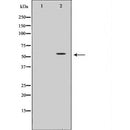Western blot analysis of extracts of Mouse liver , using HNF1A antibody. The lane on the left is treated with the antigen-specific peptide.