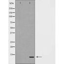 DF7185 at 1/100 staining Mouse liver tissue by IHC-P. The sample was formaldehyde fixed and a heat mediated antigen retrieval step in citrate buffer was performed. The sample was then blocked and incubated with the antibody for 1.5 hours at 22¡ãC. An HRP conjugated goat anti-rabbit antibody was used as the secondary