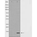 DF7186 at 1/100 staining Rat brain tissue by IHC-P. The sample was formaldehyde fixed and a heat mediated antigen retrieval step in citrate buffer was performed. The sample was then blocked and incubated with the antibody for 1.5 hours at 22¡ãC. An HRP conjugated goat anti-rabbit antibody was used as the secondary