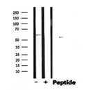 DF7191 at 1/100 staining Rat heart tissue by IHC-P. The sample was formaldehyde fixed and a heat mediated antigen retrieval step in citrate buffer was performed. The sample was then blocked and incubated with the antibody for 1.5 hours at 22¡ãC. An HRP conjugated goat anti-rabbit antibody was used as the secondary