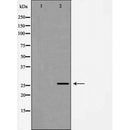 DF7192 at 1/100 staining human liver tissue sections by IHC-P. The tissue was formaldehyde fixed and a heat mediated antigen retrieval step in citrate buffer was performed. The tissue was then blocked and incubated with the antibody for 1.5 hours at 22¡ãC. An HRP conjugated goat anti-rabbit antibody was used as the secondary