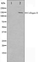 Western blot analysis on COLO205 cell lysate using Collagen II Antibody,The lane on the left is treated with the antigen-specific peptide.