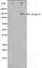 Western blot analysis on COLO205 cell lysate using Collagen II Antibody,The lane on the left is treated with the antigen-specific peptide.