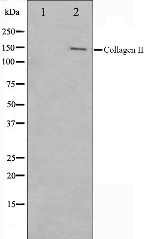 Western blot analysis on COLO205 cell lysate using Collagen II Antibody,The lane on the left is treated with the antigen-specific peptide.