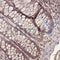 IHC analysis.