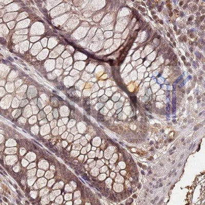 IHC analysis.
