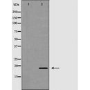 Western blot analysis of extracts of human coloncancer , using PTN antibody. The lane on the left is treated with the antigen-specific peptide.