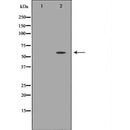 Western blot analysis of extracts of mouse eyetissue lysate, using SLC5A1antibody. The lane on the left is treated with the antigen-specific peptide.