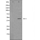 DF7205 at 1/100 staining Mouse lung tissue by IHC-P. The sample was formaldehyde fixed and a heat mediated antigen retrieval step in citrate buffer was performed. The sample was then blocked and incubated with the antibody for 1.5 hours at 22¡ãC. An HRP conjugated goat anti-rabbit antibody was used as the secondary