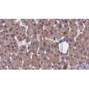 Western blot analysis of extracts from mouse brain, using SSTR2  Antibody. Lane 1 was treated with the blocking peptide.