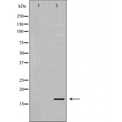 DF7217 staining U87 cells by ICC/IF. Cells were fixed with PFA and permeabilized in 0.1% saponin prior to blocking in 10% serum for 45 minutes at 37¡ãC. The primary antibody was diluted 1/200 and incubated with the sample for 1 hour at 37¡ãC. A  Alexa Fluor 594 conjugated goat polyclonal to rabbit IgG (H+L), diluted 1/600 was used as secondary antibod