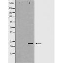 DF7232 at 1/100 staining Mouse colon tissue by IHC-P. The sample was formaldehyde fixed and a heat mediated antigen retrieval step in citrate buffer was performed. The sample was then blocked and incubated with the antibody for 1.5 hours at 22¡ãC. An HRP conjugated goat anti-rabbit antibody was used as the secondary