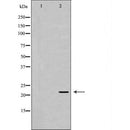 DF7236 at 1/100 staining Human Melanoma tissue by IHC-P. The sample was formaldehyde fixed and a heat mediated antigen retrieval step in citrate buffer was performed. The sample was then blocked and incubated with the antibody for 1.5 hours at 22¡ãC. An HRP conjugated goat anti-rabbit antibody was used as the secondary