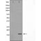 DF7239 at 1/100 staining Human Melanoma tissue by IHC-P. The sample was formaldehyde fixed and a heat mediated antigen retrieval step in citrate buffer was performed. The sample was then blocked and incubated with the antibody for 1.5 hours at 22¡ãC. An HRP conjugated goat anti-rabbit antibody was used as the secondary