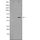 DF7240 at 1/100 staining Human prostate tissue by IHC-P. The sample was formaldehyde fixed and a heat mediated antigen retrieval step in citrate buffer was performed. The sample was then blocked and incubated with the antibody for 1.5 hours at 22¡ãC. An HRP conjugated goat anti-rabbit antibody was used as the secondary
