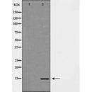 Western blot analysis of extracts of HeLa, using H3K14me3 antibody. The lane on the left is treated with the antigen-specific peptide.