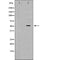 DF7254 at 1/100 staining Mouse pancreas tissue by IHC-P. The sample was formaldehyde fixed and a heat mediated antigen retrieval step in citrate buffer was performed. The sample was then blocked and incubated with the antibody for 1.5 hours at 22¡ãC. An HRP conjugated goat anti-rabbit antibody was used as the secondary