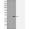 DF7261 staining Hela by IF/ICC. The sample were fixed with PFA and permeabilized in 0.1% Triton X-100,then blocked in 10% serum for 45 minutes at 25¡ãC. The primary antibody was diluted at 1/200 and incubated with the sample for 1 hour at 37¡ãC. An  Alexa Fluor 594 conjugated goat anti-rabbit IgG (H+L) Ab, diluted at 1/600, was used as the secondary antibod