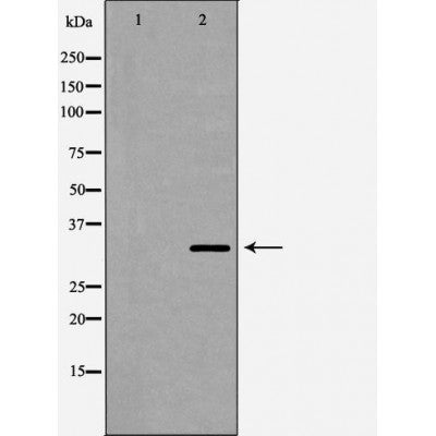 DF7261 staining Hela by IF/ICC. The sample were fixed with PFA and permeabilized in 0.1% Triton X-100,then blocked in 10% serum for 45 minutes at 25¡ãC. The primary antibody was diluted at 1/200 and incubated with the sample for 1 hour at 37¡ãC. An  Alexa Fluor 594 conjugated goat anti-rabbit IgG (H+L) Ab, diluted at 1/600, was used as the secondary antibod