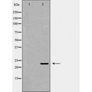 DF7270 at 1/100 staining Rat lung tissue by IHC-P. The sample was formaldehyde fixed and a heat mediated antigen retrieval step in citrate buffer was performed. The sample was then blocked and incubated with the antibody for 1.5 hours at 22¡ãC. An HRP conjugated goat anti-rabbit antibody was used as the secondary