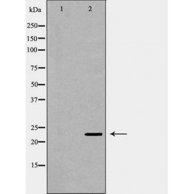 DF7270 at 1/100 staining Rat lung tissue by IHC-P. The sample was formaldehyde fixed and a heat mediated antigen retrieval step in citrate buffer was performed. The sample was then blocked and incubated with the antibody for 1.5 hours at 22¡ãC. An HRP conjugated goat anti-rabbit antibody was used as the secondary