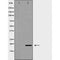 DF7276 at 1/100 staining Human kidney tissue by IHC-P. The sample was formaldehyde fixed and a heat mediated antigen retrieval step in citrate buffer was performed. The sample was then blocked and incubated with the antibody for 1.5 hours at 22¡ãC. An HRP conjugated goat anti-rabbit antibody was used as the secondary