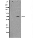 DF7279 at 1/100 staining Human breast cancer tissue by IHC-P. The sample was formaldehyde fixed and a heat mediated antigen retrieval step in citrate buffer was performed. The sample was then blocked and incubated with the antibody for 1.5 hours at 22¡ãC. An HRP conjugated goat anti-rabbit antibody was used as the secondary