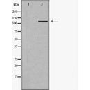 DF7280 at 1/100 staining Human liver cancer tissue by IHC-P. The sample was formaldehyde fixed and a heat mediated antigen retrieval step in citrate buffer was performed. The sample was then blocked and incubated with the antibody for 1.5 hours at 22¡ãC. An HRP conjugated goat anti-rabbit antibody was used as the secondary